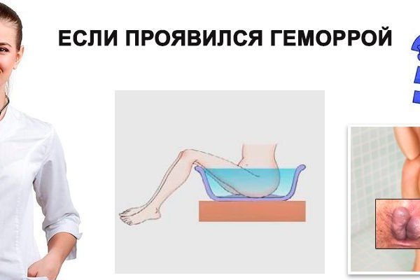 Ссылка на кракен тор